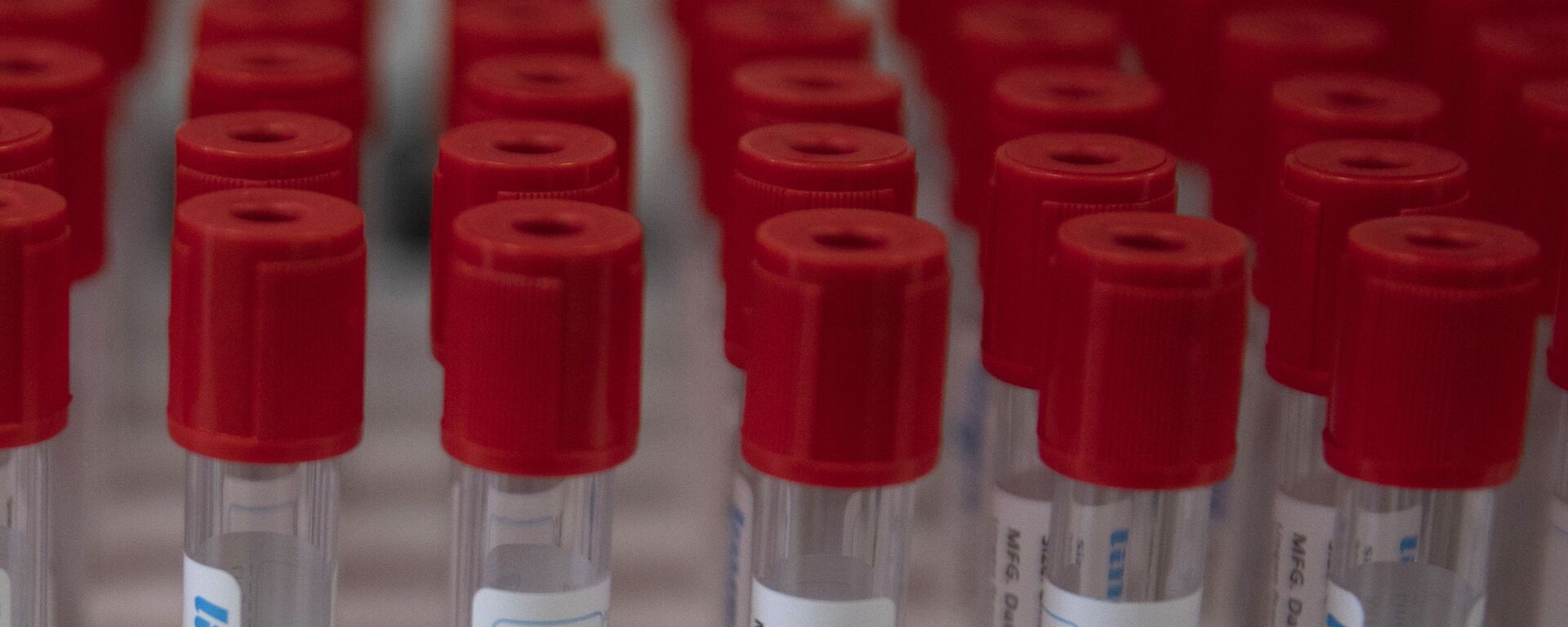 اختبارات - لقاح مضاد فيروس كورونا، مايو 2020 - سبوتنيك عربي, 1920, 10.11.2024