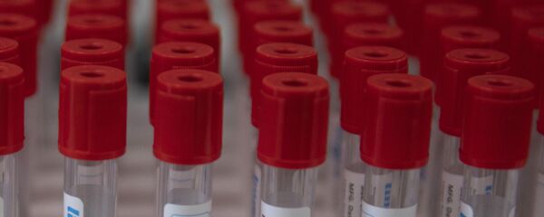 اختبارات - لقاح مضاد فيروس كورونا، مايو 2020 اختبارات - لقاح مضاد فيروس كورونا، مايو 2020 - سبوتنيك عربي