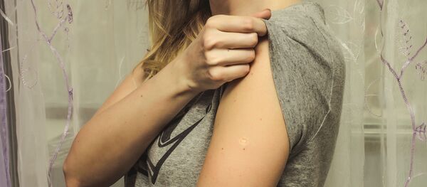 امرأة تمتلك ندبة على يدها - سبوتنيك عربي