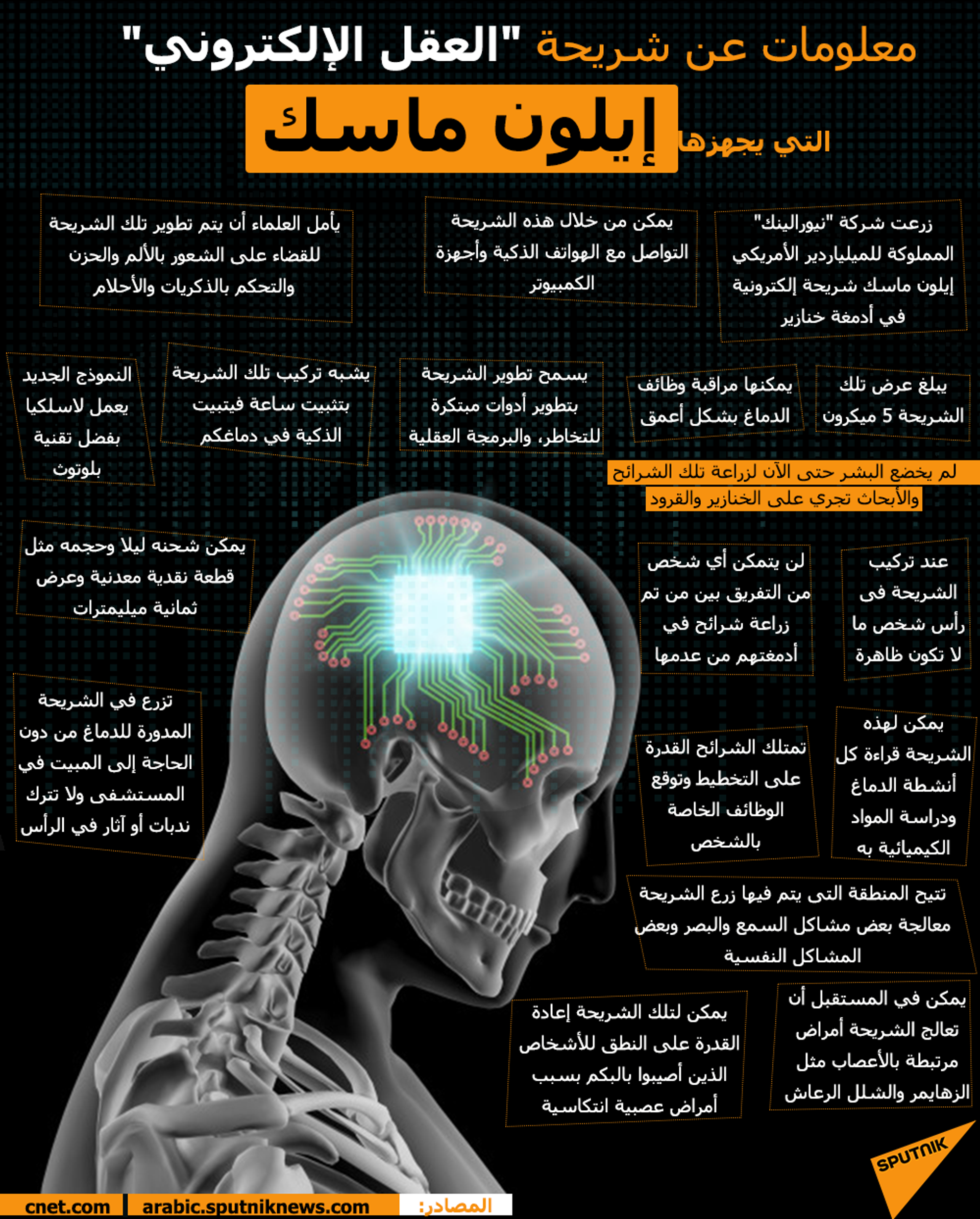 معلومات عن شريحة العقل الإلكتروني التي يجهزها إيلون ماسك - سبوتنيك عربي, 1920, 09.06.2022