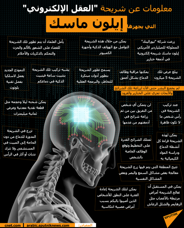 معلومات تفصيلية عن شريحة إيلون ماسك الإلكترونية... فيديو - سبوتنيك عربي