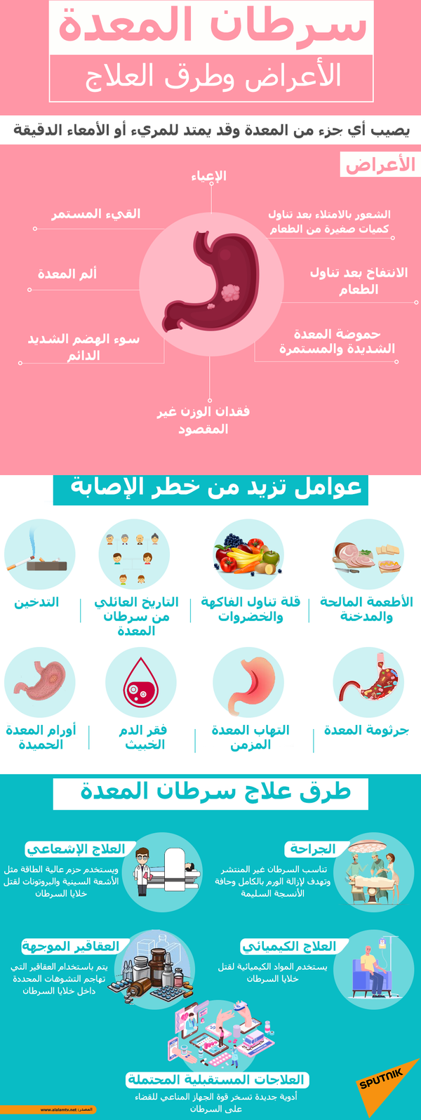 ابتكار بسيط لعلاج الحموضة أثناء النوم ... فيديو - سبوتنيك عربي