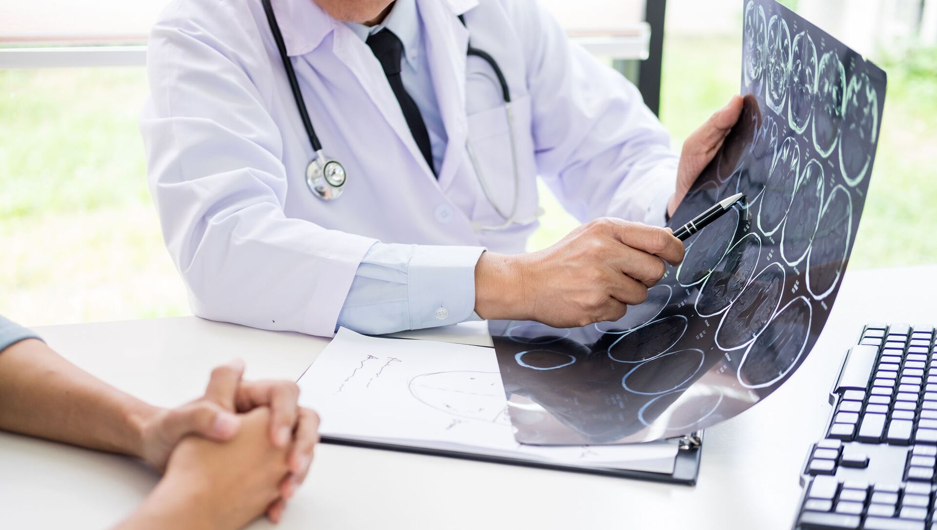 التصوير المقطعي المحوسب لدماغ المريض التصوير المقطعي المحوسب لدماغ المريض - سبوتنيك عربي, 1920, 05.04.2021