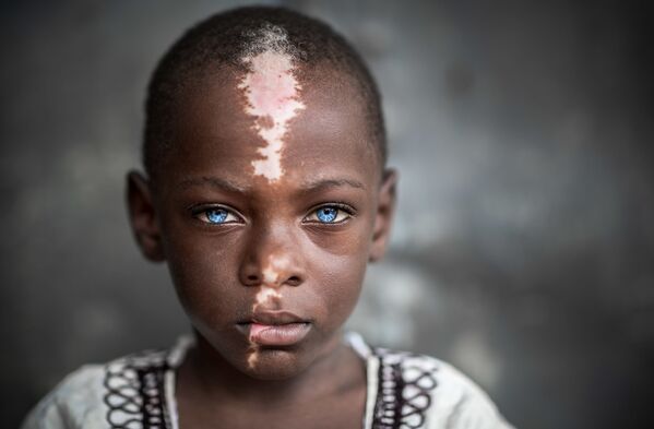 صورة بعنوان شاكول (صبي مصاب بمتلازمة واردينبيرغ)، للمصور الإماراتي بول-فلاد إبور، المرشح لنهائي المسابقة عن فئة بورتريه قصة، من مسابقة التصوير الدولية أفضل مصور البورتريه للعام 2021 - سبوتنيك عربي