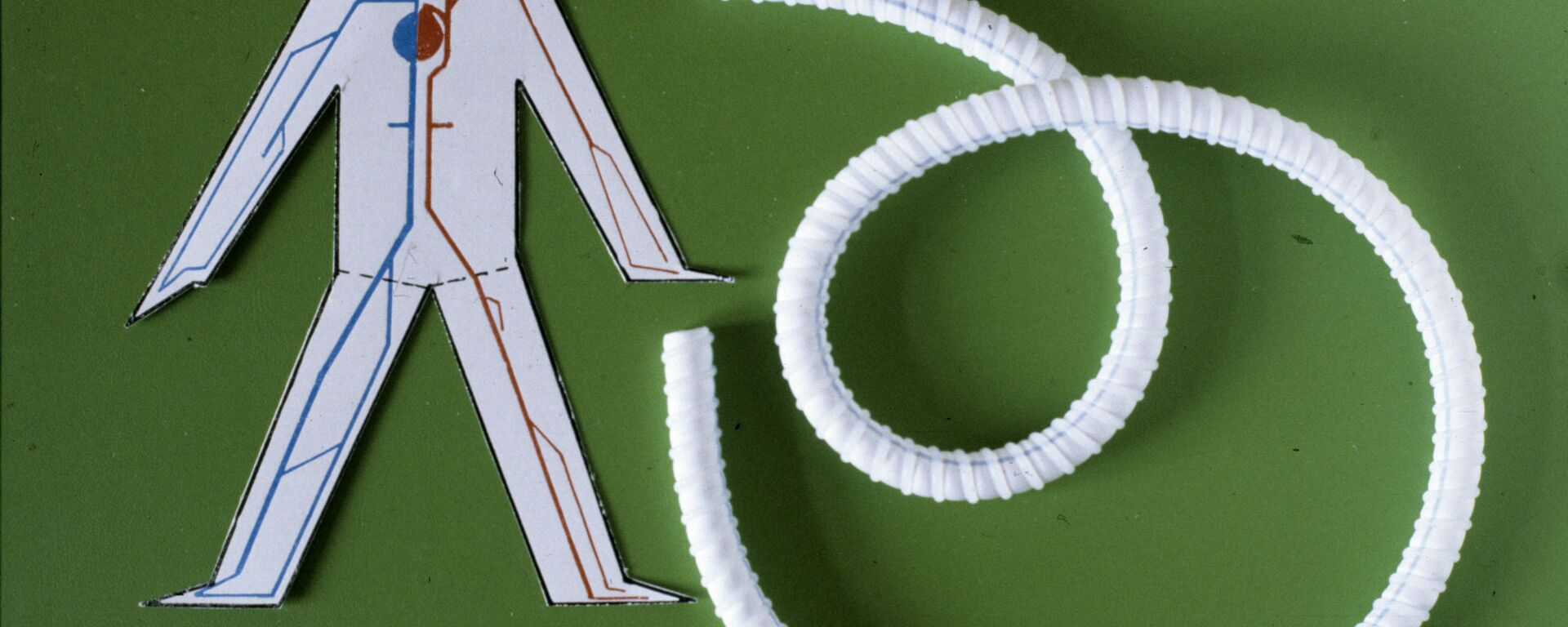 أمراض الشرايين ومشاكل تدفق الدم عبرها - سبوتنيك عربي, 1920, 08.02.2022