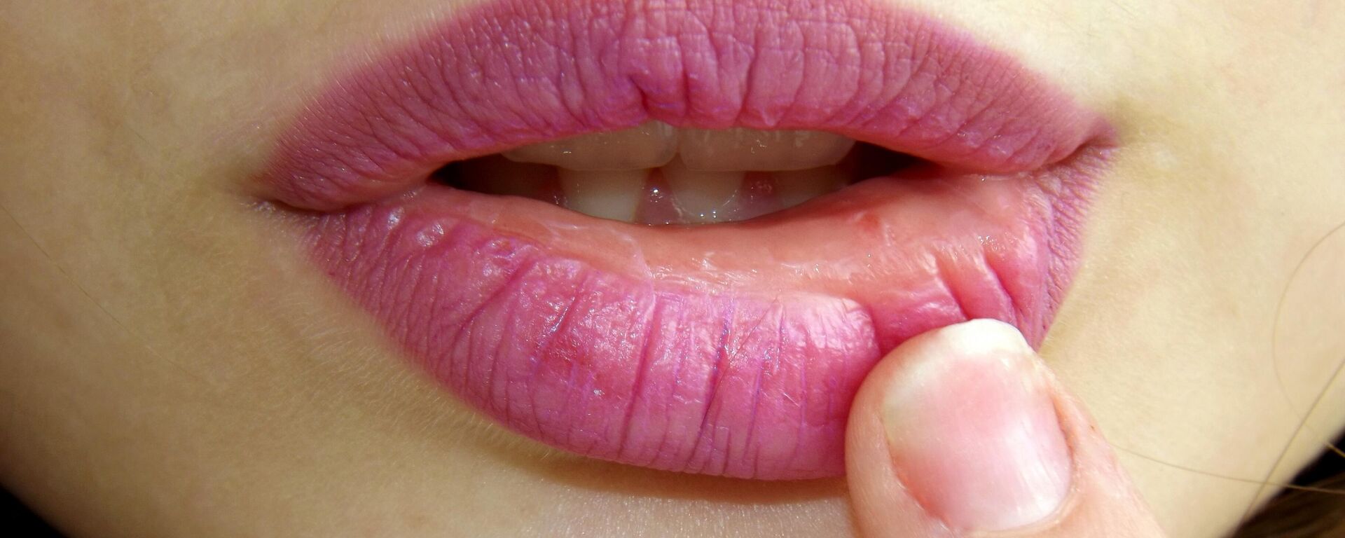 شفاه تظهر عليها علامات المرض  - سبوتنيك عربي, 1920, 09.02.2022