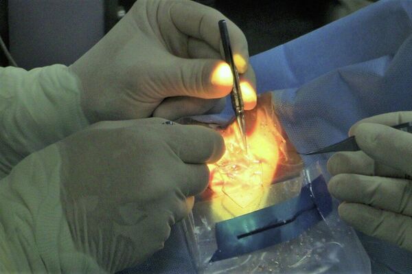 إجراء عمليات زراعة القرنية في قطاع غزة ضمن مبادرة &quot;ومن أحياها&quot; - سبوتنيك عربي