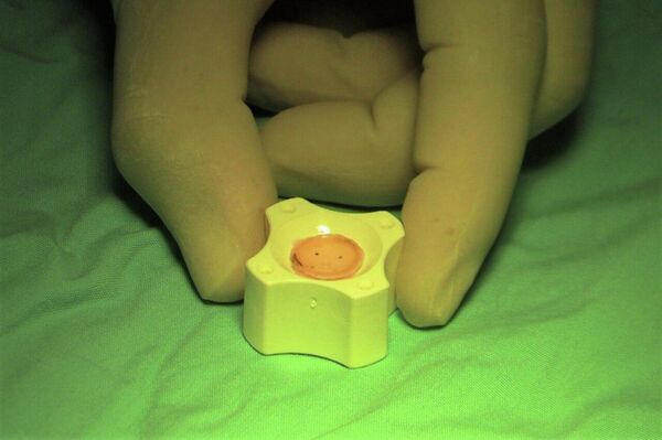 إجراء عمليات زراعة القرنية في قطاع غزة ضمن مبادرة &quot;ومن أحياها&quot; - سبوتنيك عربي