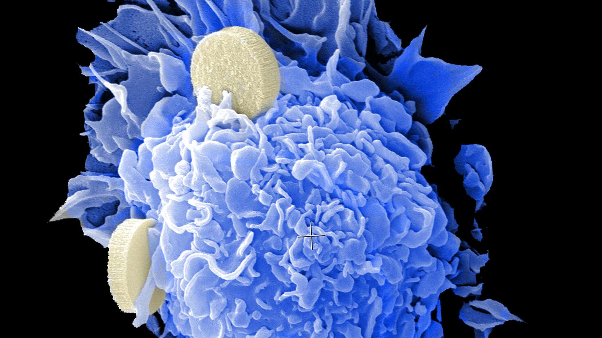 دراسة: الزواج قد يرتبط بانخفاض خطر الإصابة بالسرطان