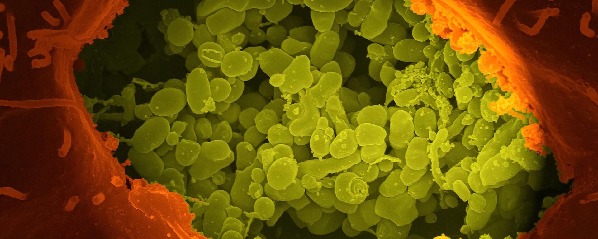 جراثيم وفطريات داخل الأنسجة  - سبوتنيك عربي, 1920, 03.04.2023