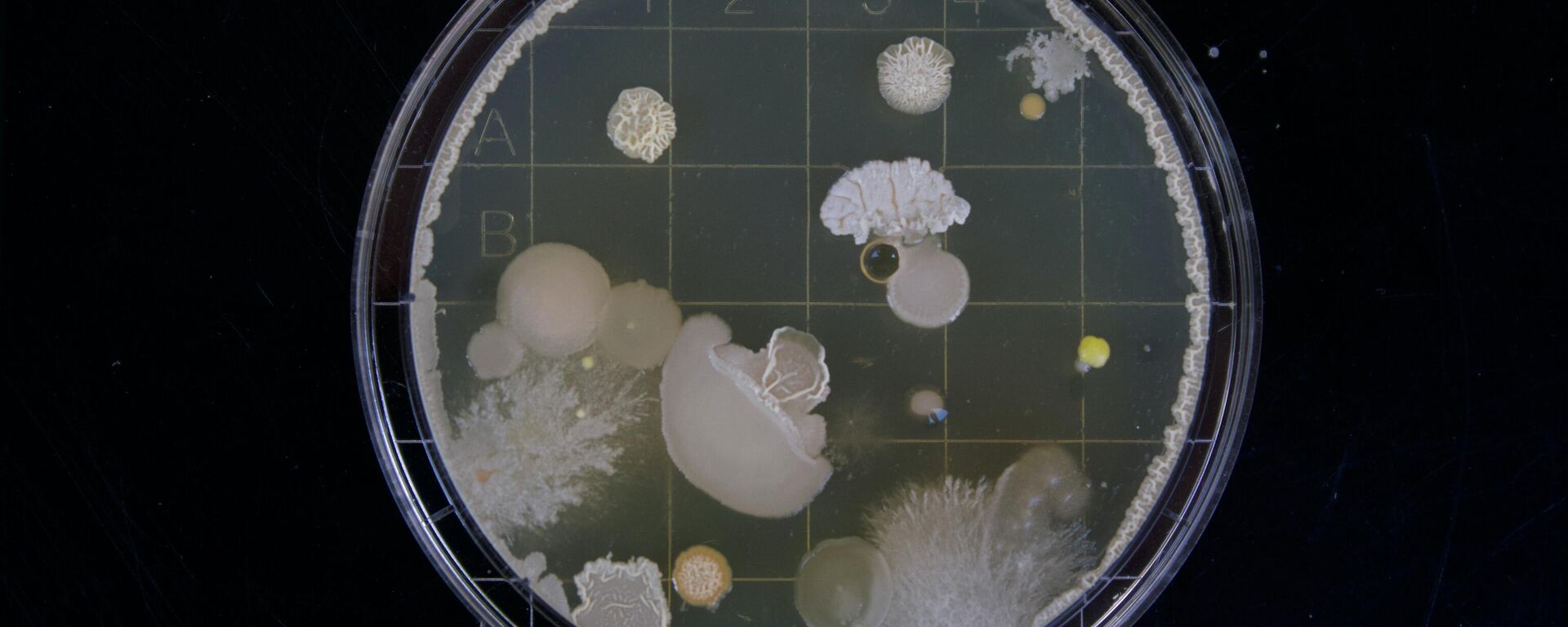 أحد أصناف البكتيريا داخل وعاء خاص - سبوتنيك عربي, 1920, 26.07.2025