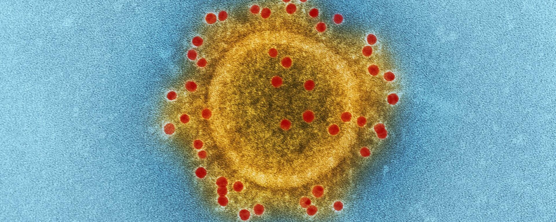 صورة لفيروس في بيئة دراسية  - سبوتنيك عربي, 1920, 05.05.2023