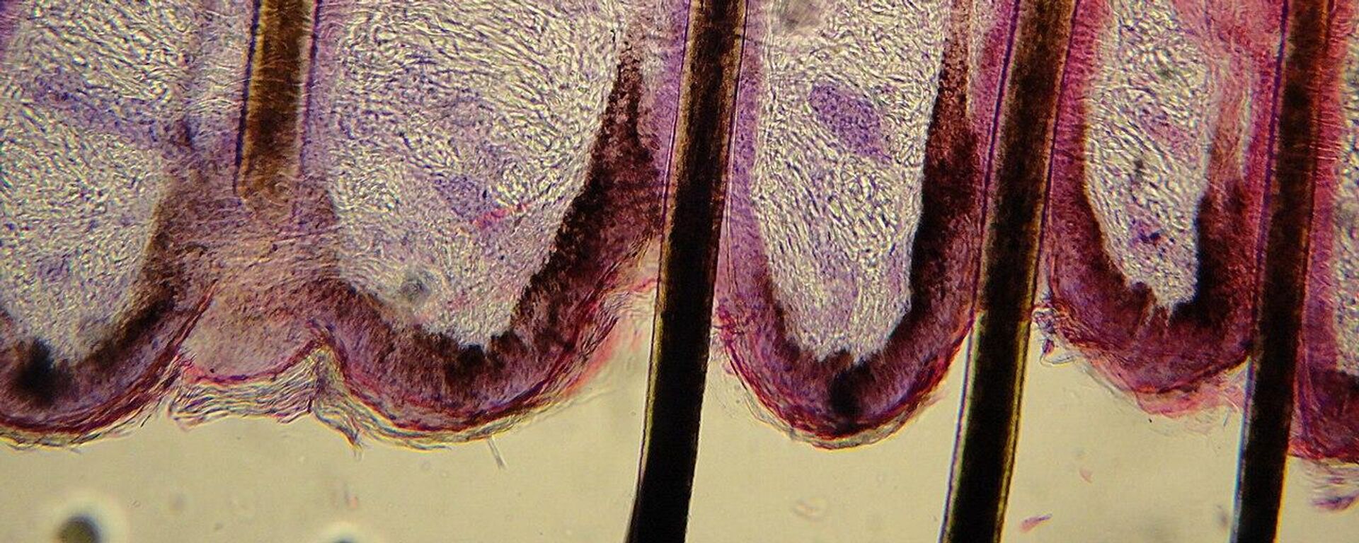 صورة تظهر الشعر بداخل جلد الإنسان وجزء من جريب الشعر (البصيلات)  - سبوتنيك عربي, 1920, 18.11.2023