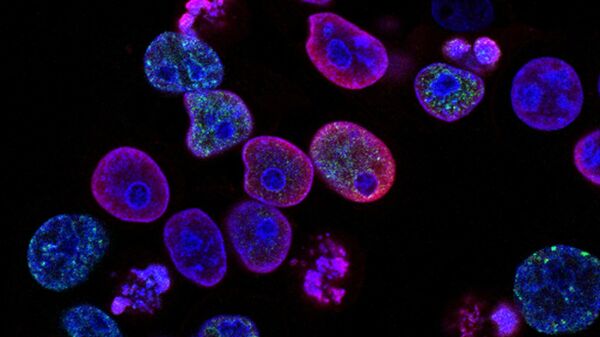 علاج خلايا سرطان القولون والمستقيم البشرية بمثبط التوبويزوميراز ومثبط بروتين كيناز - سبوتنيك عربي