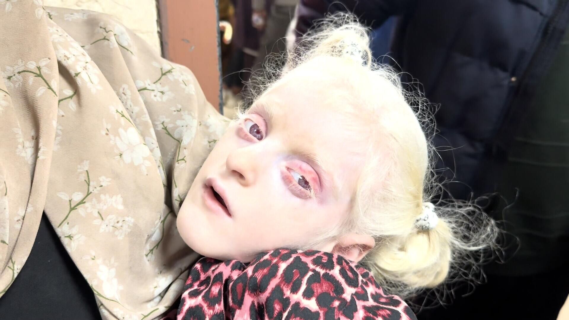 قطاع غزة يواجه الجوع الكارثي وسوء التغذية يهدد حياة الأطفال  - سبوتنيك عربي, 1920, 26.03.2024