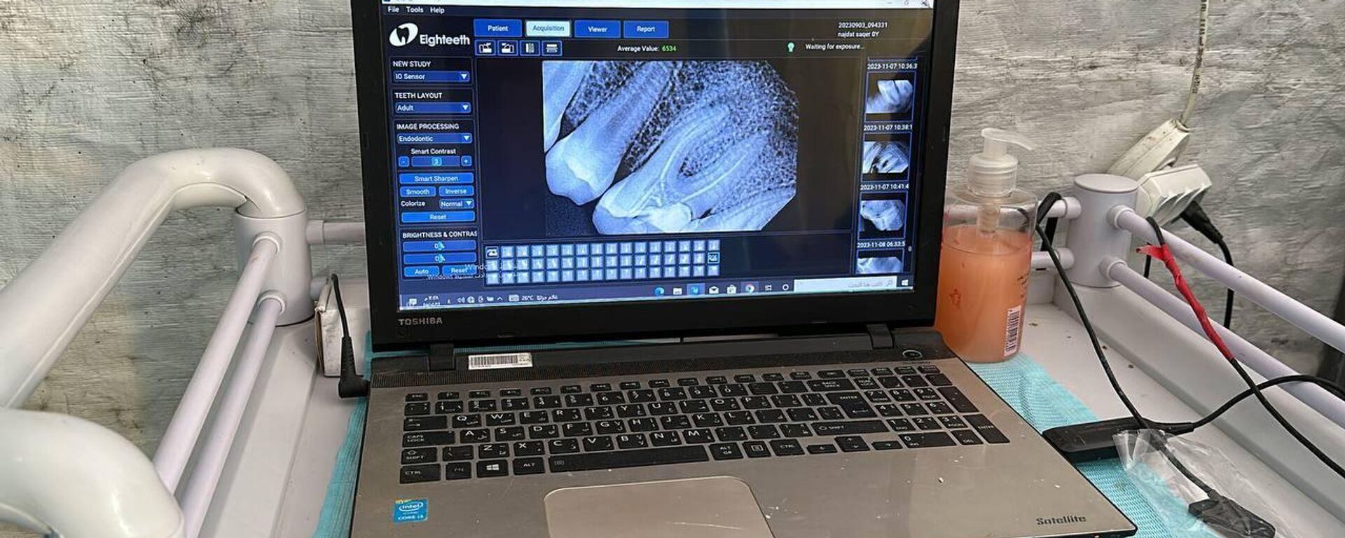 خيمة الأسنان  طبيب يحوّل خيمة النزوح إلى عيادة أسنان لعلاج المرضى في مخيم النصيرات وسط قطاع غزة  - سبوتنيك عربي, 1920, 27.02.2026