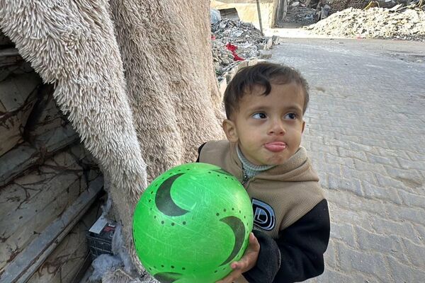 طفل فلسطيني يواجه ورما يطفئ عينه وحصارا يمنعه من السفر للعلاج في الخارج - سبوتنيك عربي