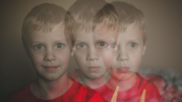 صورة لطفل مصاب بمرض المبتسم الخطير - سبوتنيك عربي