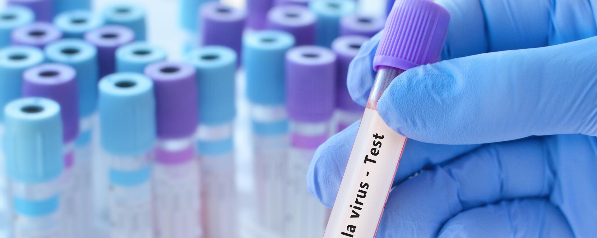 طبيب يحمل أنبوب عينة دم اختبار فيروس الإيبولا على خلفية أنابيب الاختبار الطبية مع التحاليل - سبوتنيك عربي, 1920, 30.01.2025