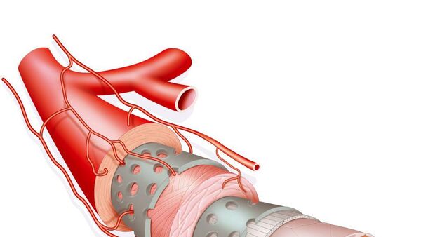 جلطة دماغية - سبوتنيك عربي