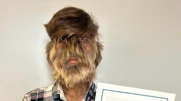 شاب هندي يدخل موسوعة غينيس بسبب - سبوتنيك عربي