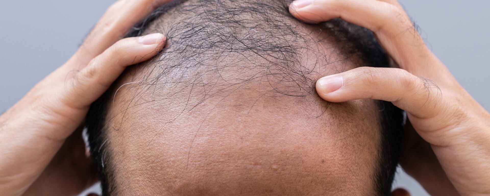 رجل أصلع - سبوتنيك عربي, 1920, 21.03.2025