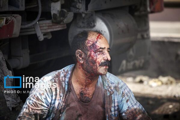 أحد المصابين نتيجة انفجار ميناء رجائي الإيراني والدماء تسيل من جبينه نتيجة الصدمة القوية الناتجة عن قوة التفجير.  - سبوتنيك عربي