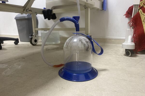 صورة تظهر حال المستشفيات المتردي في قطاع غزة صورة تظهر حال المستشفيات المتردي في قطاع غزة - سبوتنيك عربي