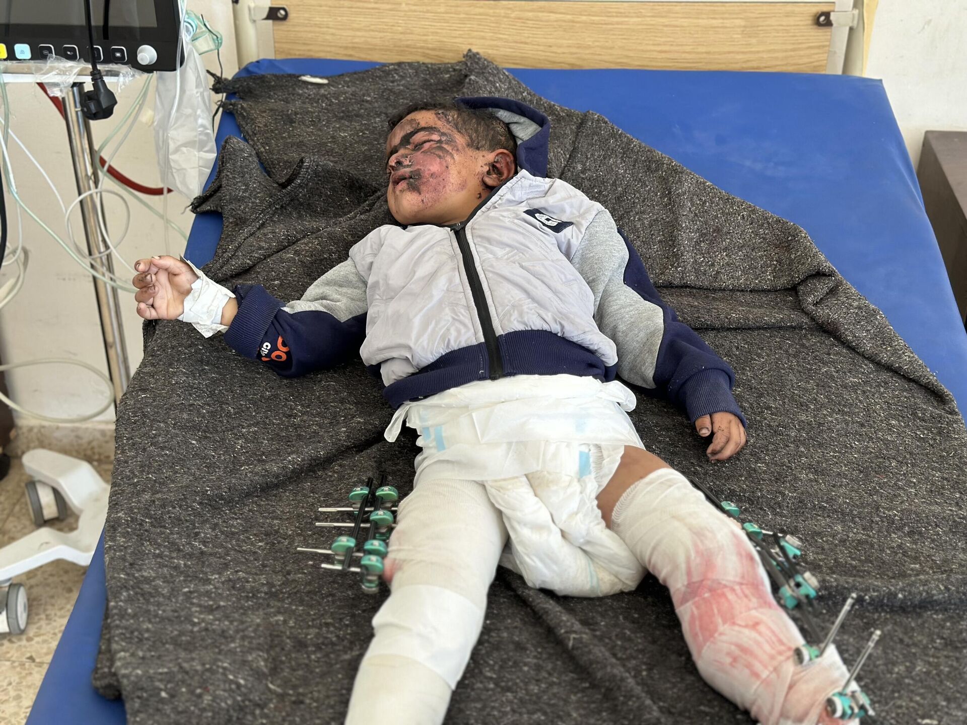 سعيد طفل نجا من القصف في قطاع غزة - سبوتنيك عربي, 1920, 07.05.2025