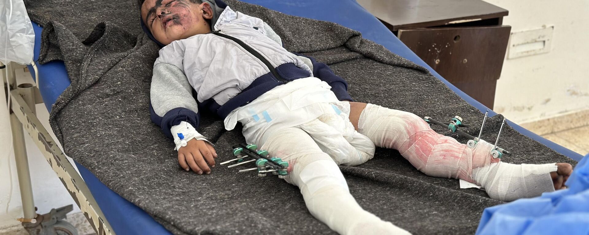 سعيد طفل نجا من القصف في قطاع غزة - سبوتنيك عربي, 1920, 07.05.2025