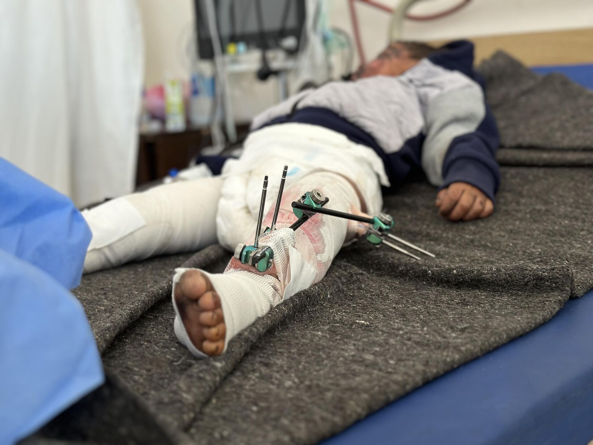 سعيد طفل نجا من القصف في قطاع غزة - سبوتنيك عربي, 1920, 07.05.2025