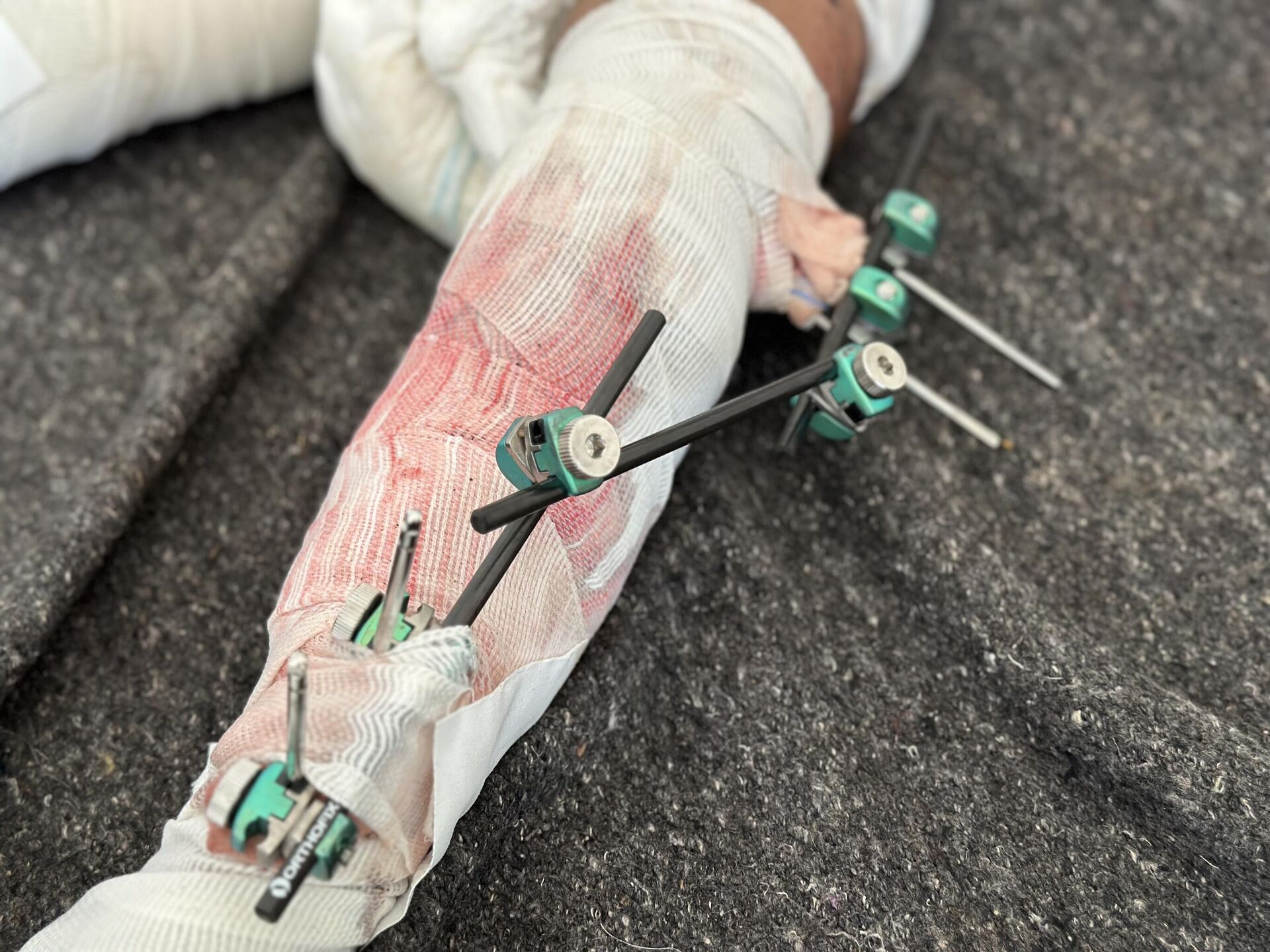 سعيد طفل نجا من القصف في قطاع غزة - سبوتنيك عربي, 1920, 07.05.2025