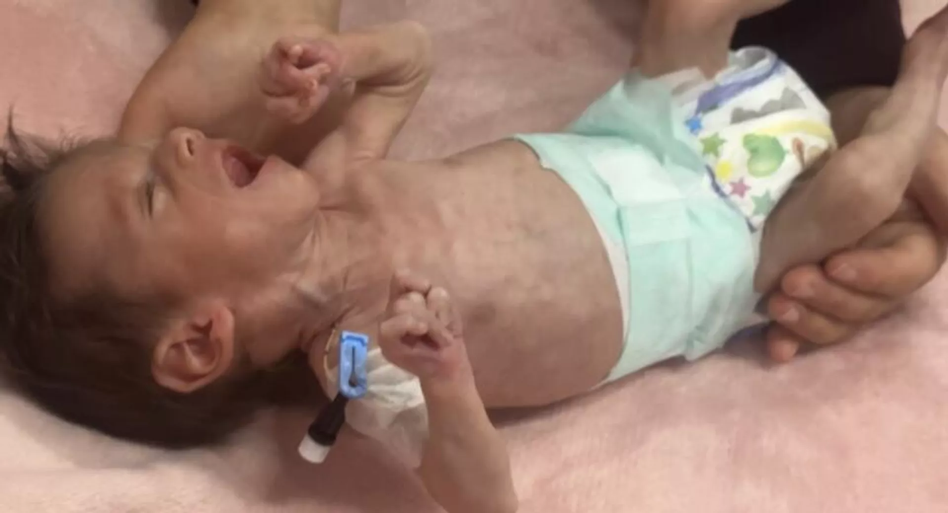 سوء التغذية يهدد حياة آلاف الأطفال  في غزة - سبوتنيك عربي, 1920, 12.05.2025