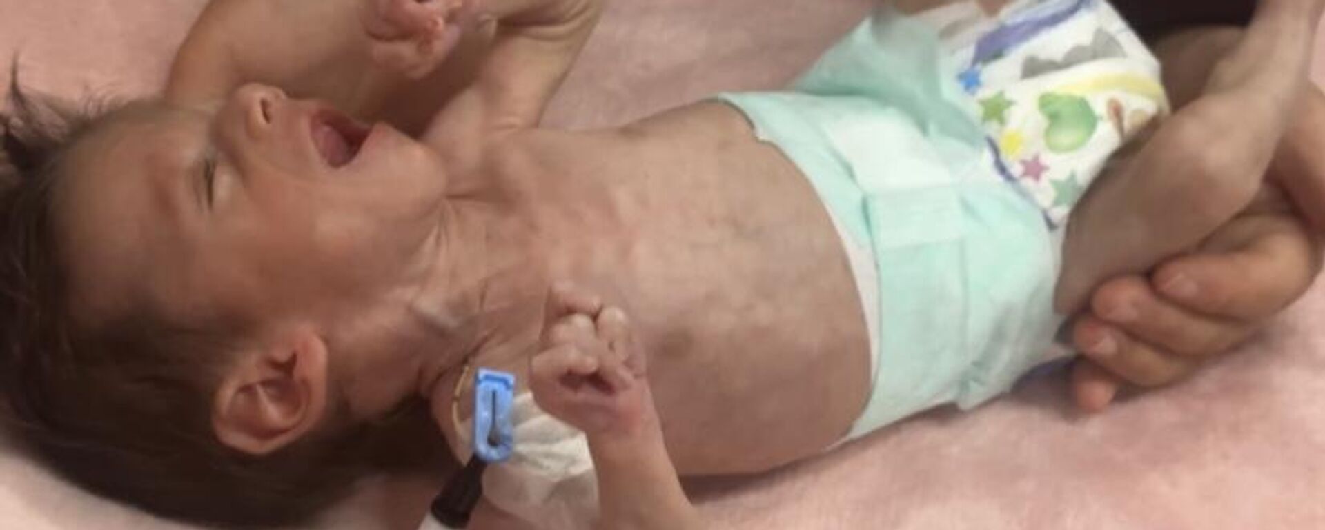 سوء التغذية يهدد حياة آلاف الأطفال  في غزة - سبوتنيك عربي, 1920, 13.05.2025