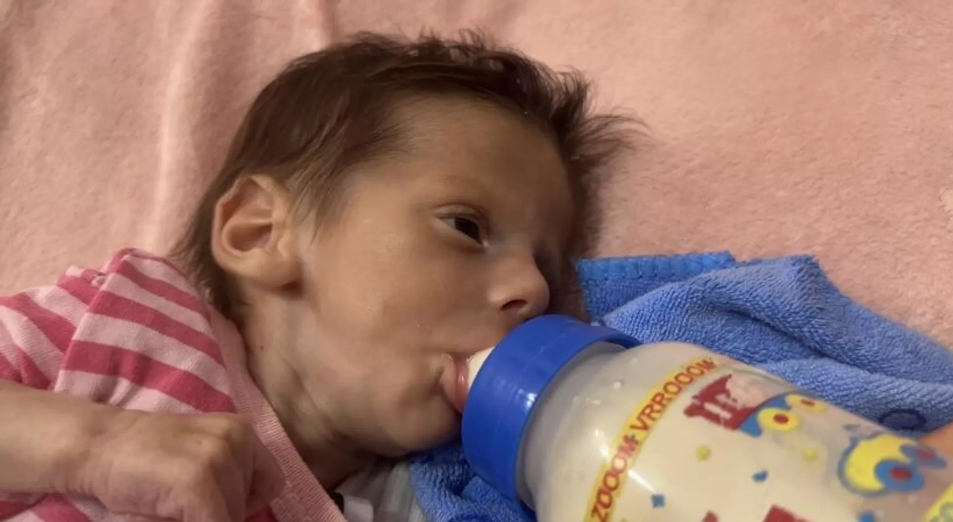 سوء التغذية يهدد حياة آلاف الأطفال  في غزة - سبوتنيك عربي, 1920, 12.05.2025