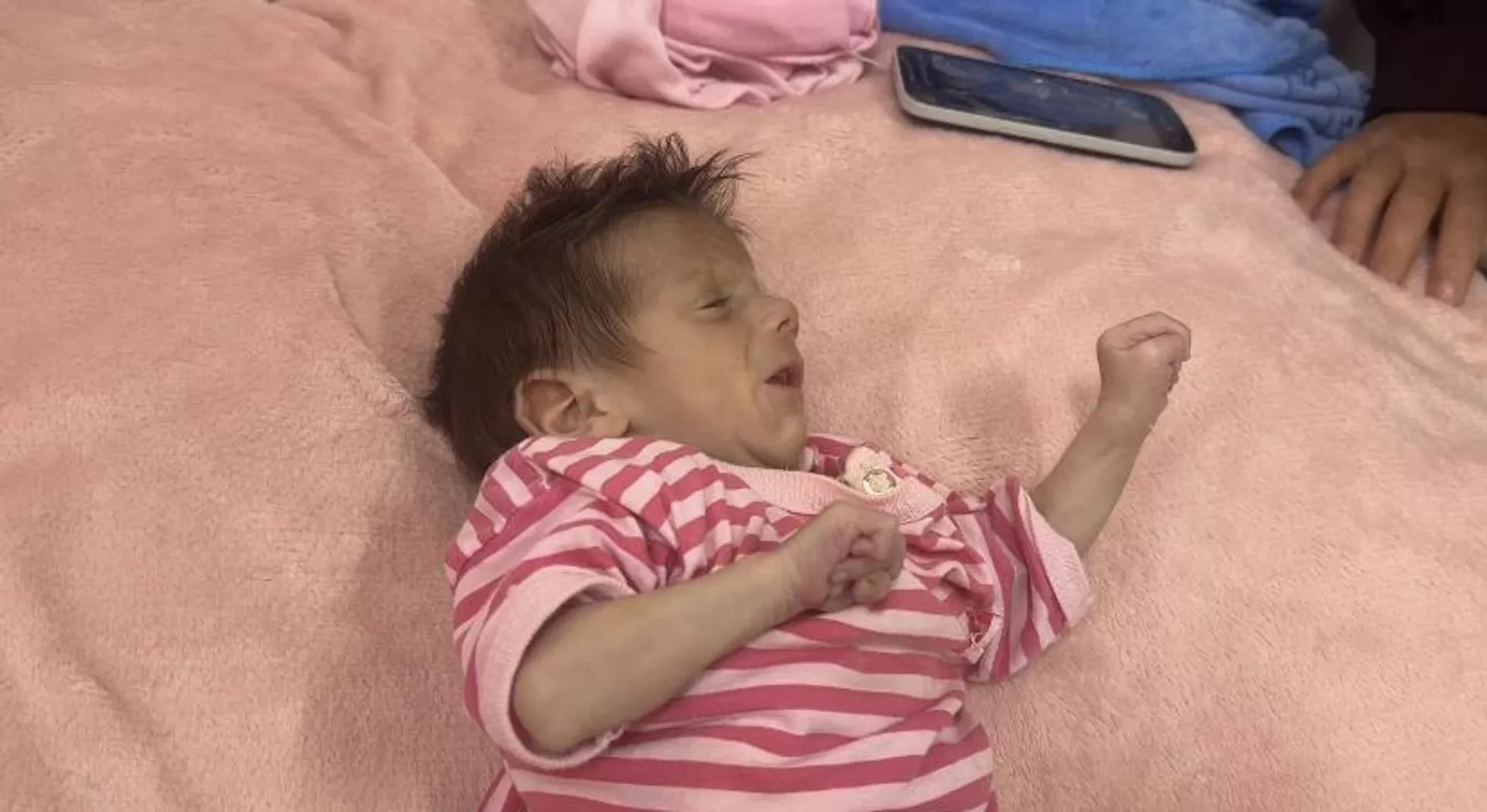 سوء التغذية يهدد حياة آلاف الأطفال  في غزة - سبوتنيك عربي, 1920, 12.05.2025