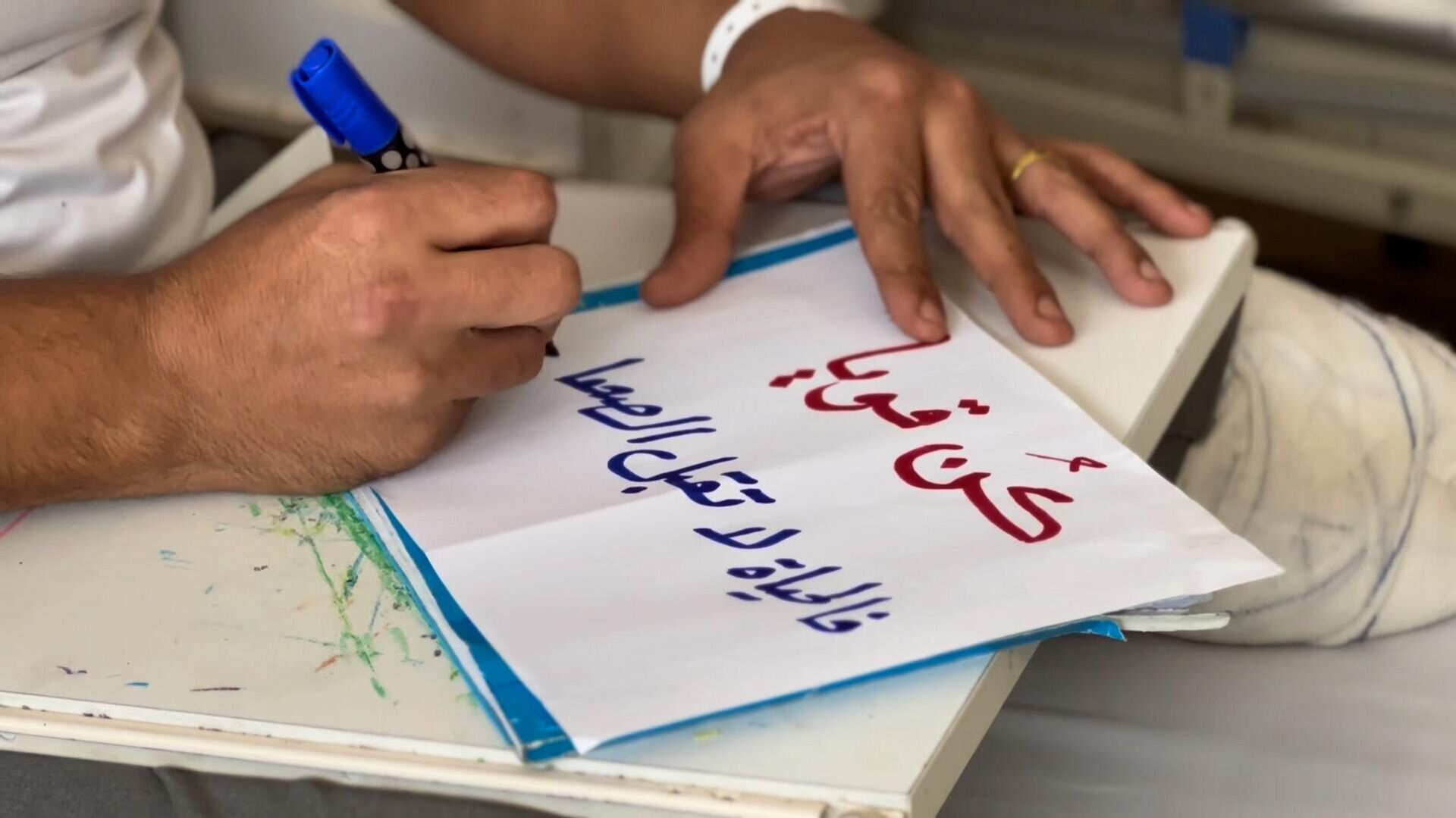 فلسطيني يعبر بالرسم عن فقد قدمه ومعاناته داخل المشفى في قطاع غزة   - سبوتنيك عربي, 1920, 21.05.2025