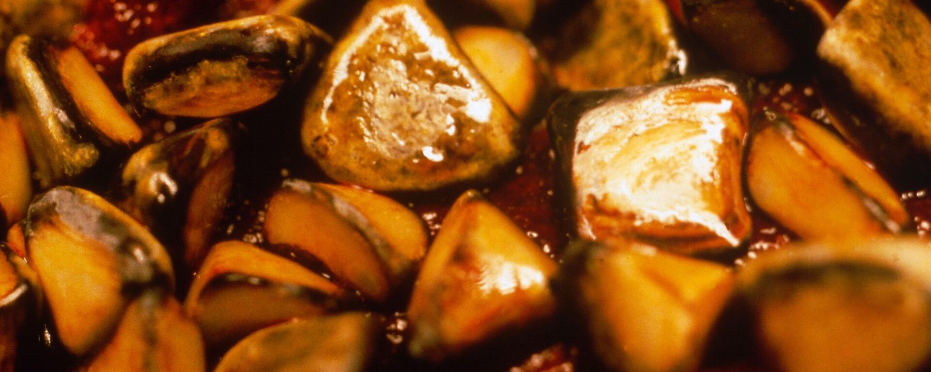 حصوات كلى - سبوتنيك عربي, 1920, 27.05.2025