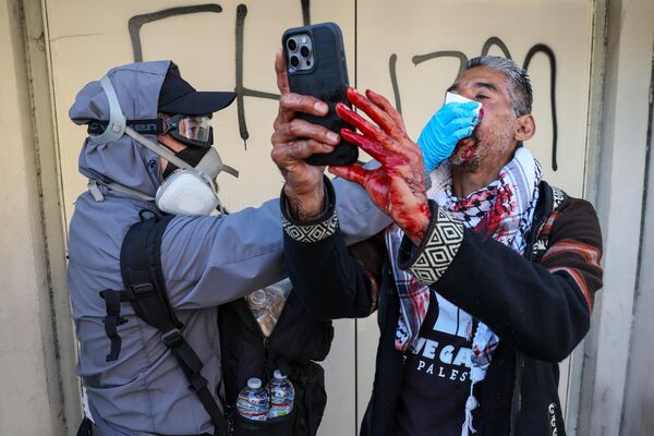  متظاهر يلتقط صورة سيلفي بينما كان مسعف يعتني بوجهه الملطخ بالدماء بعد إصابته برصاصة مطاطية أطلقها ضابط شرطة لوس أنجلوس في شارع تيمبل ولوس أنجلوس.  - سبوتنيك عربي