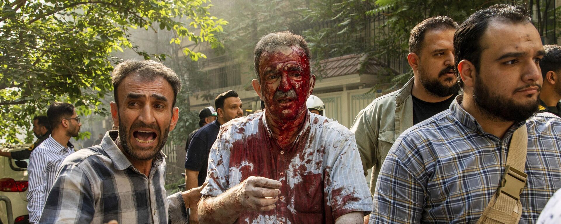 رجل مصاب تتم مساعدته لمغادرة مكان الحادث بعد انفجار في وسط مدينة طهران - سبوتنيك عربي, 1920, 16.06.2025