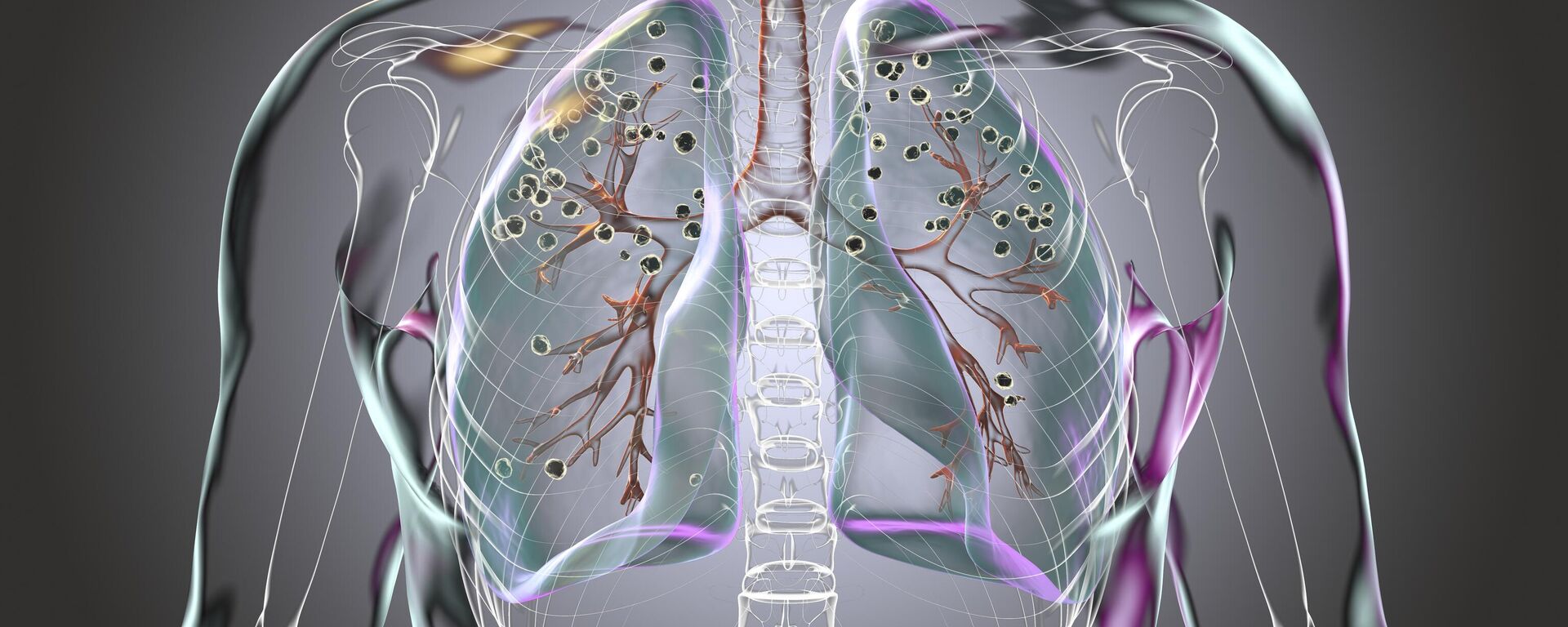 صورة للرئة  - سبوتنيك عربي, 1920, 18.06.2025