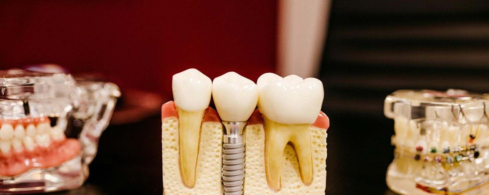 طب الأسنان - سبوتنيك عربي, 1920, 19.10.2025