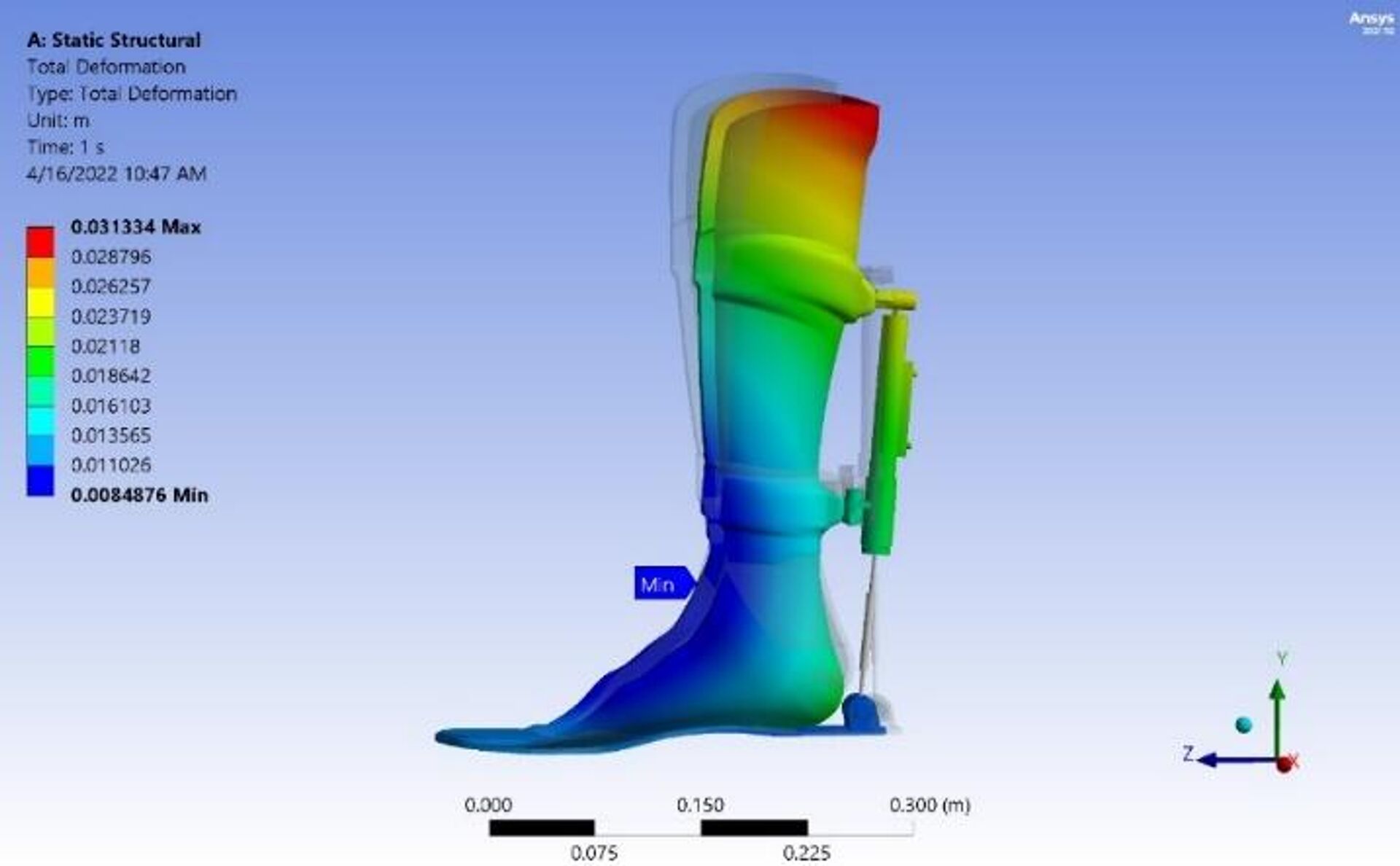 صور لابتكار نفذه علماء روس ينقذ الساقين من البتر - سبوتنيك عربي, 1920, 26.06.2025