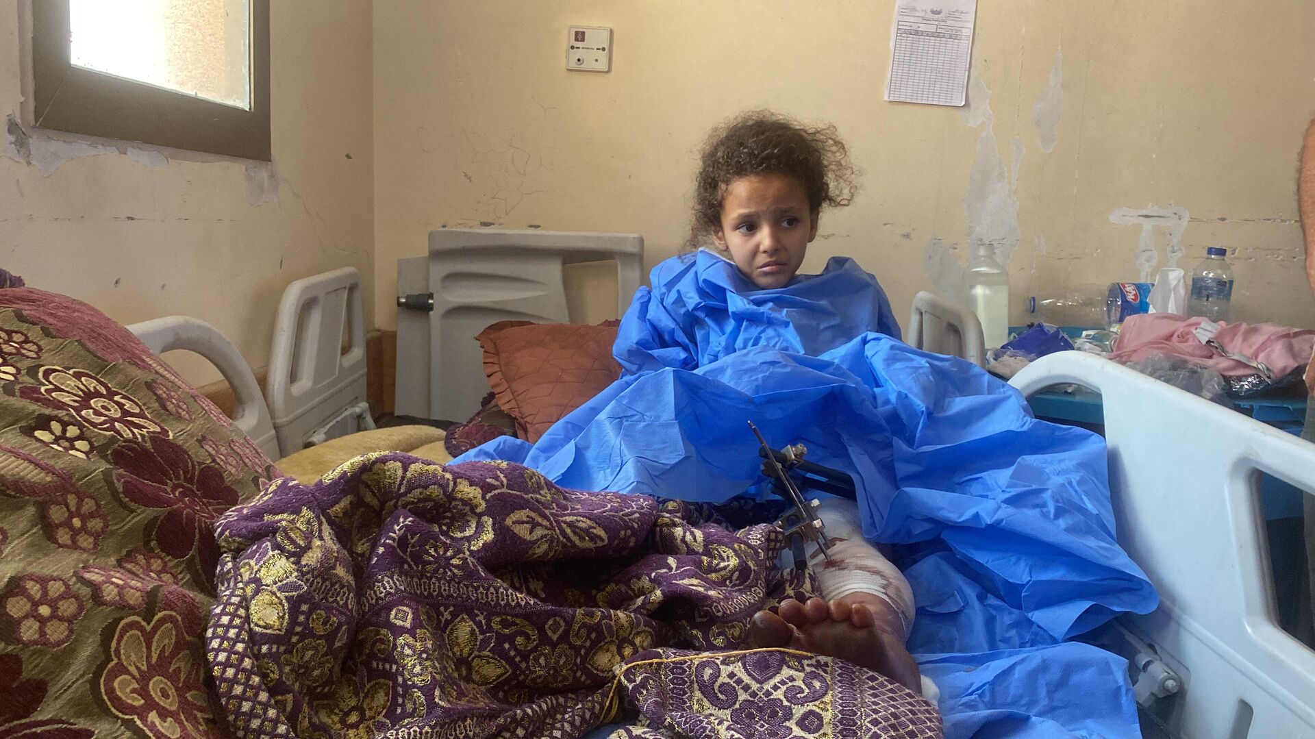 الطفلة سيلا تفقد ساقيها وتحلم بالمشي مجددا   - سبوتنيك عربي, 1920, 26.06.2025