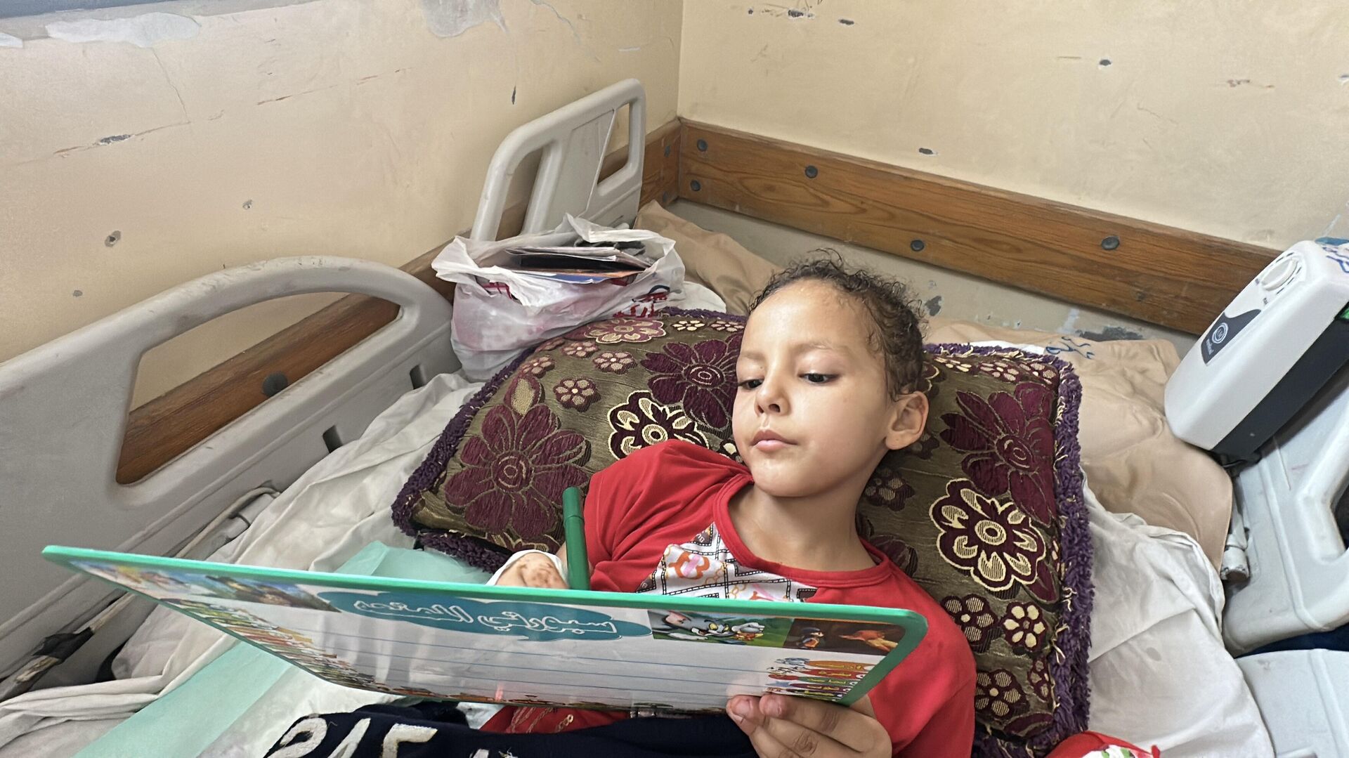 الطفلة سيلا تفقد ساقيها وتحلم بالمشي مجددا   - سبوتنيك عربي, 1920, 26.06.2025