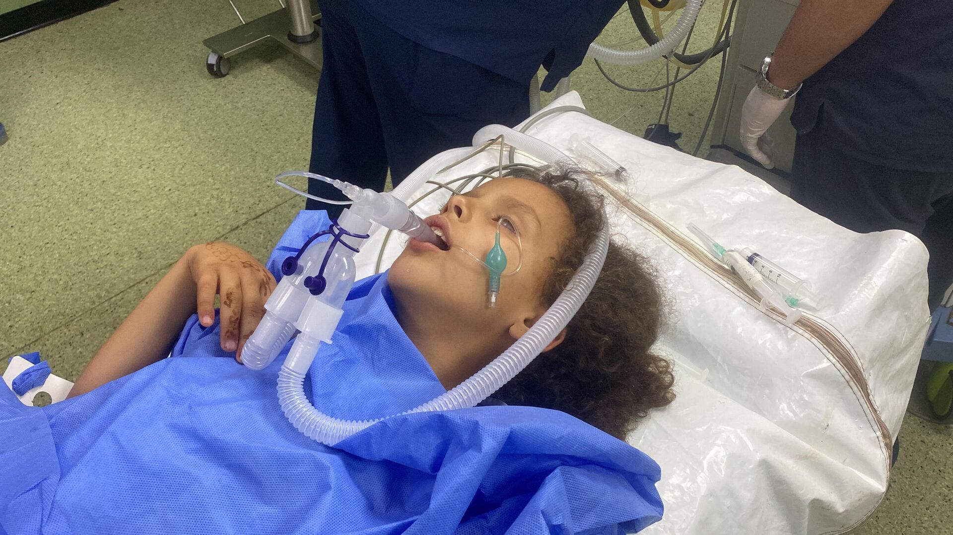 الطفلة سيلا تفقد ساقيها وتحلم بالمشي مجددا   - سبوتنيك عربي, 1920, 26.06.2025