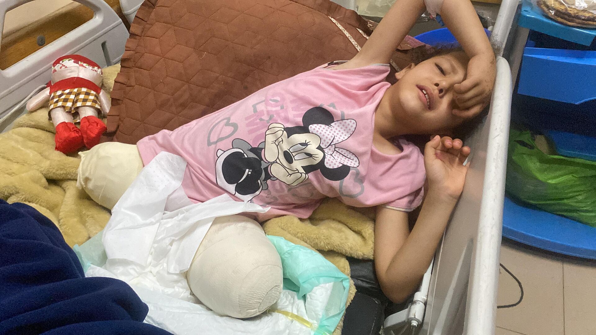 الطفلة سيلا تفقد ساقيها وتحلم بالمشي مجددا   - سبوتنيك عربي, 1920, 26.06.2025