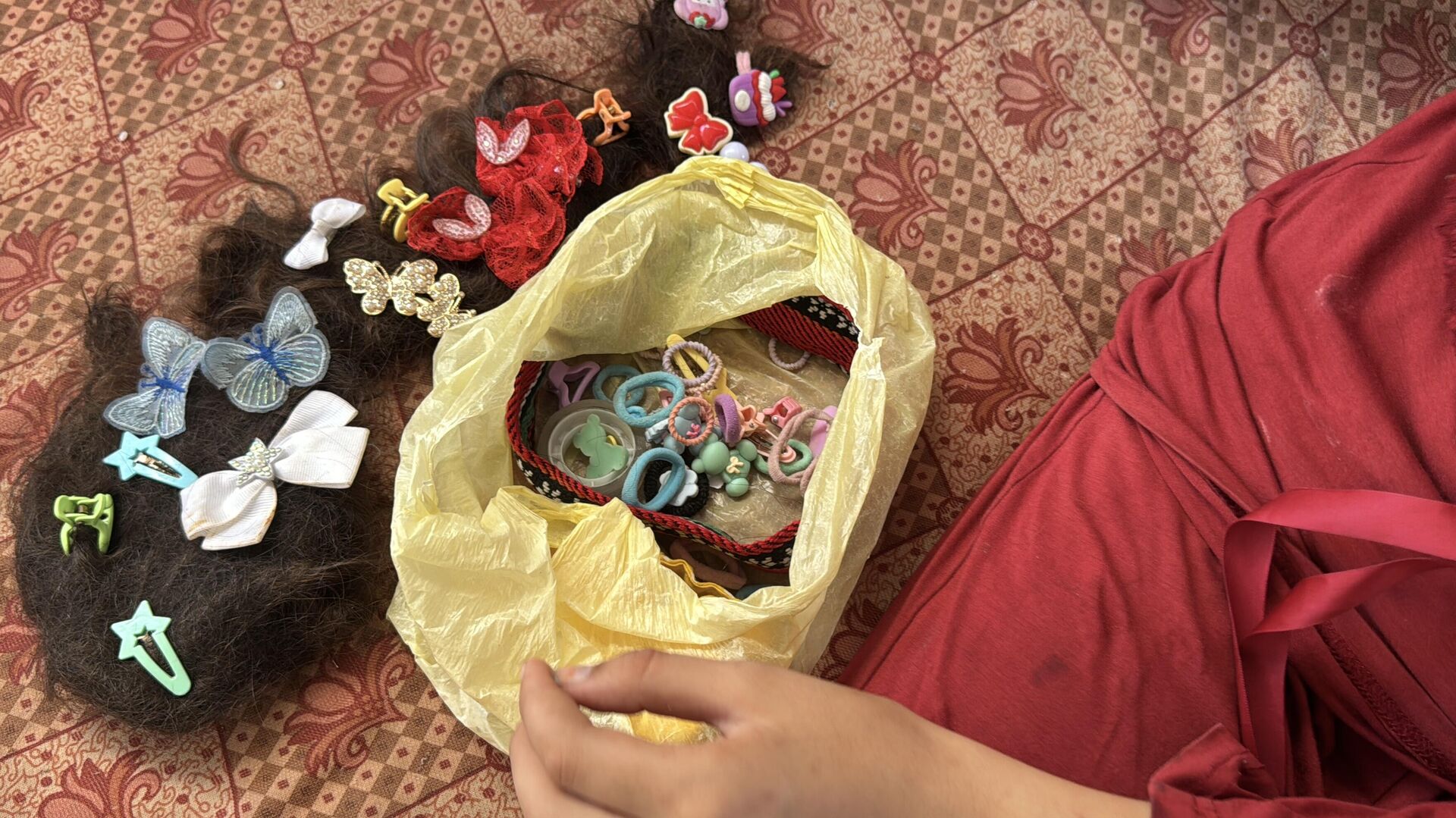 طفلة فلسطينية تحلم بعودة شعرها الذي أحرقته قذائف الحرب  - سبوتنيك عربي, 1920, 10.07.2025