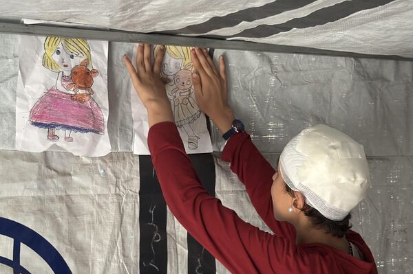 طفلة فلسطينية تحلم بعودة شعرها الذي أحرقته قذائف الحرب  - سبوتنيك عربي