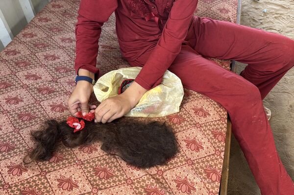 طفلة فلسطينية تحلم بعودة شعرها الذي أحرقته قذائف الحرب  - سبوتنيك عربي